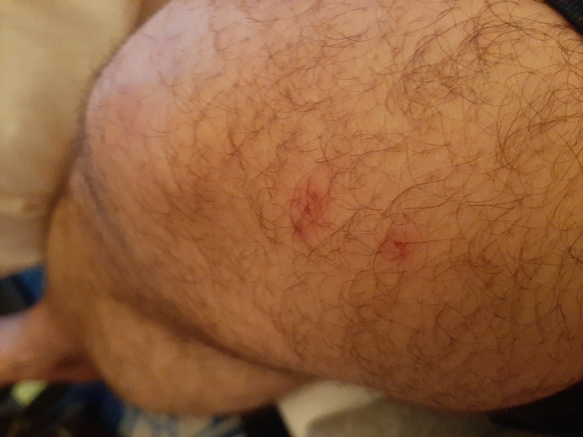       Close-up of hairy skin with blemishes.
  