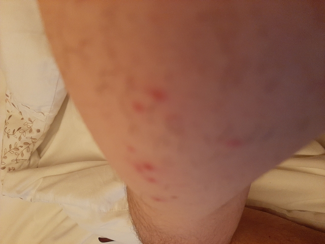       Close-up of skin with blemishes or rash.
  