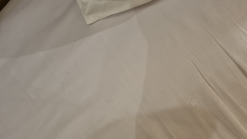       Close-up of a blemished bed sheet.
  