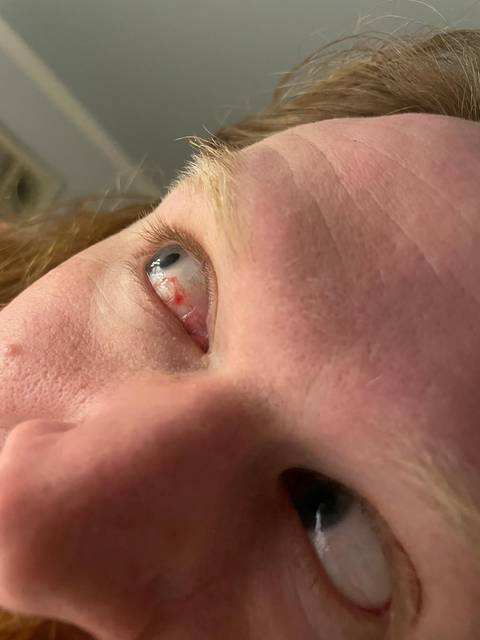 Close-up of a person's eye.