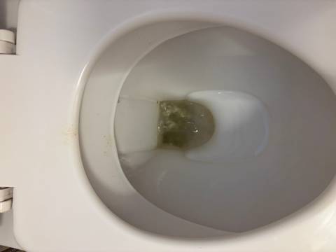       Toilet bowl mid-flush with discolored water.
  